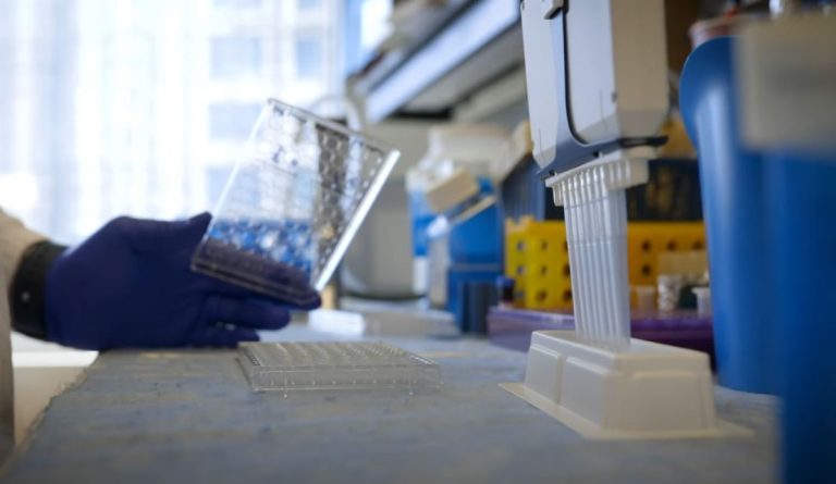 northwestern medicine lupus cure